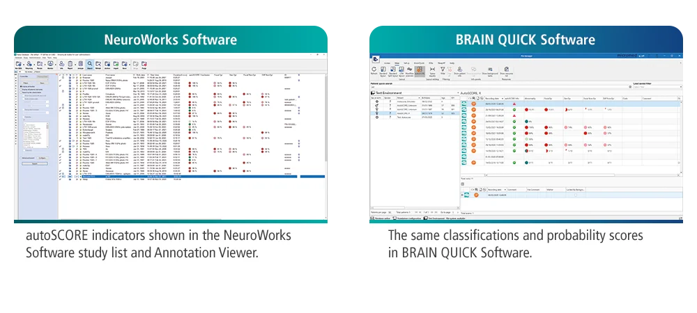 autoSCORE en NeuroWorks Software y BRAIN QUICK Software